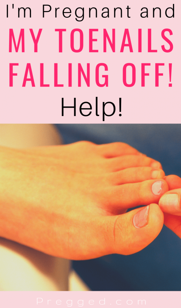 Are your toenails falling off during pregnancy? This strange pregnancy symptom is not as uncommon as you may think! Find out why it happens and what you can do about it...#pregnancysymptoms #pregnancyhealth #pregnancy