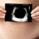 Blighted Ovum – It’s a Miscarriage NOT a Phantom Pregnancy